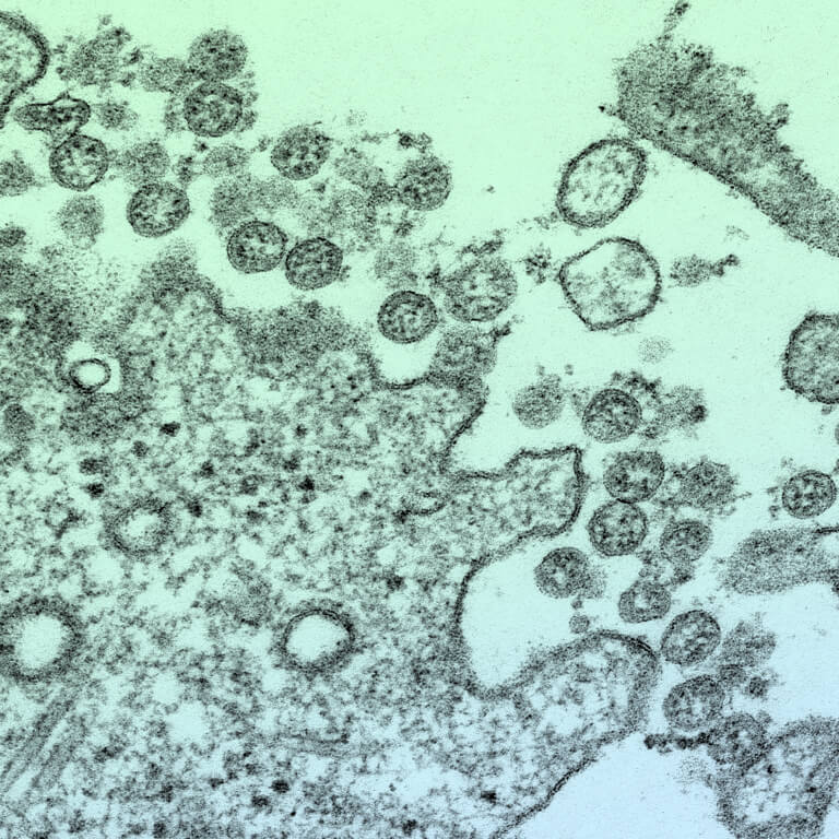covid-19 microscope slide