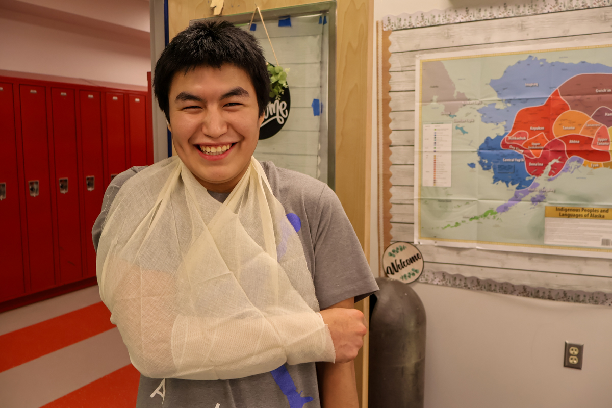 student in Nulato wears sling he made