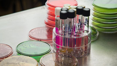 A collection of petri dishes and vials.